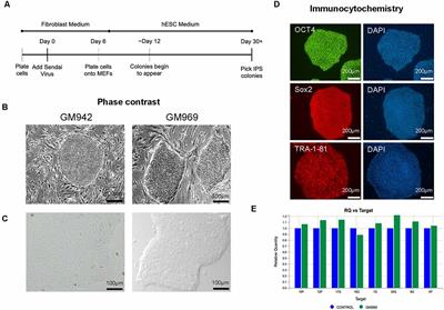 Novel Scalable and Simplified System to Generate Microglia-Containing Cerebral Organoids From Human Induced Pluripotent Stem Cells